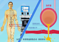 人和醫(yī)院 尿潴留、尿失禁動畫